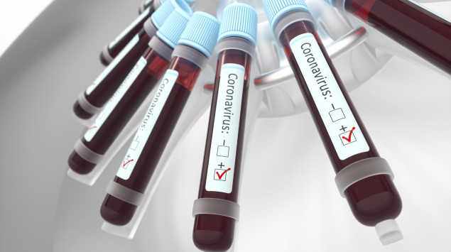 Blutproben zum Test für Coronavirus