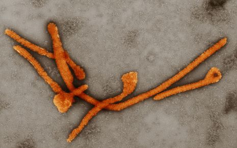 Man sieht eine Ebola-Viren unter dem Elektronenmikroskop.