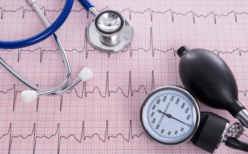 Ein EKG gehört zur Standarduntersuchung bei Verdacht auf Herzrhythmusstörungen.