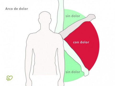 Causas del hombro congelado