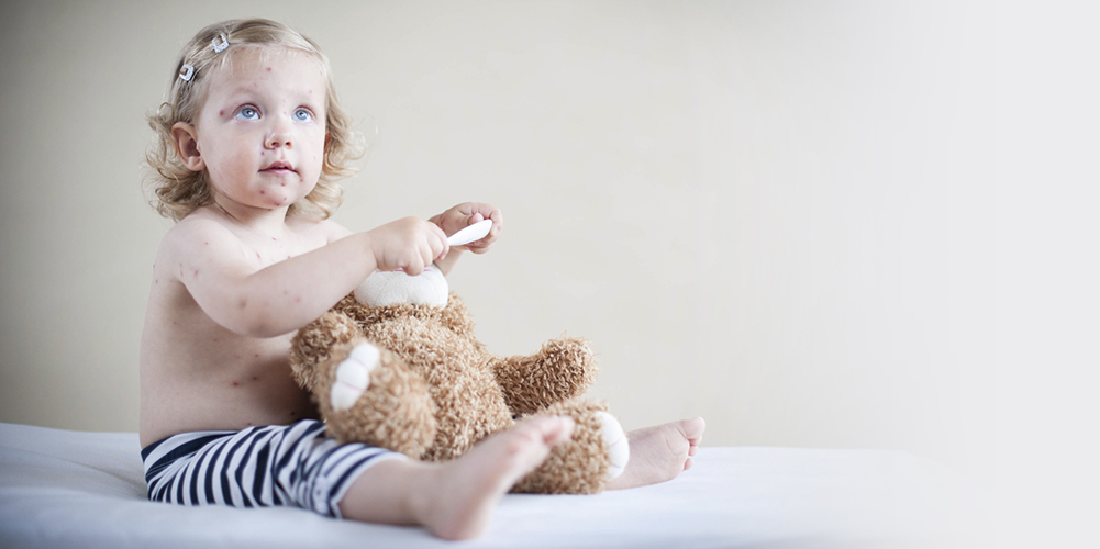 enfermedades infantiles con erupciones cutaneas