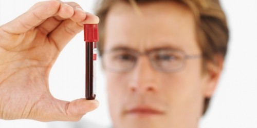 Velocidad de sedimentacion baja en sangre