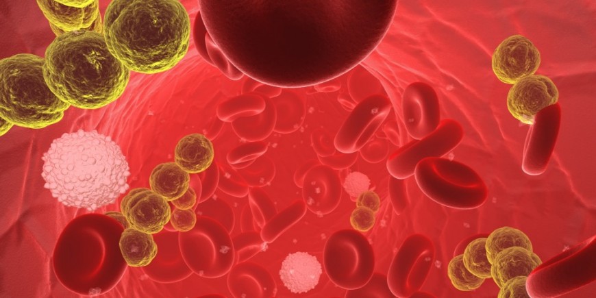 infecciones en la sangre en adultos infecciones en la sangre en adultos