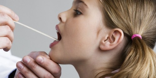 La escarlatina es contagiosa en ninos