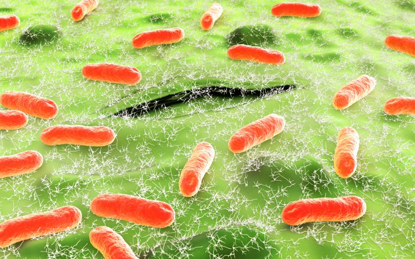Escherichia coli-Bakterien (orange) sind der häufigste Auslöser von Harnwegsinfekten.