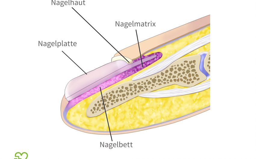 Bilder Nagelverfärbungen: Man sieht eine Grafik mit einem Querschnitt durch den Finger.