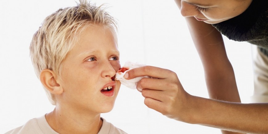 Epistaxis Saignement De Nez Chez Un Enfant Cela A Du Anciens Et Reunions