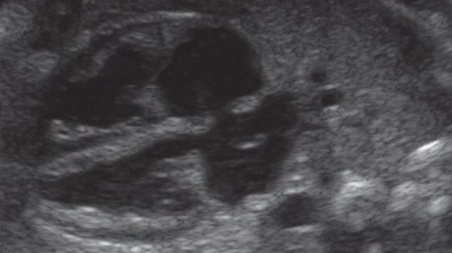 Entwicklung Embryo Fotus Baby Onmeda De
