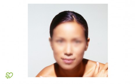 Prosopagnosie