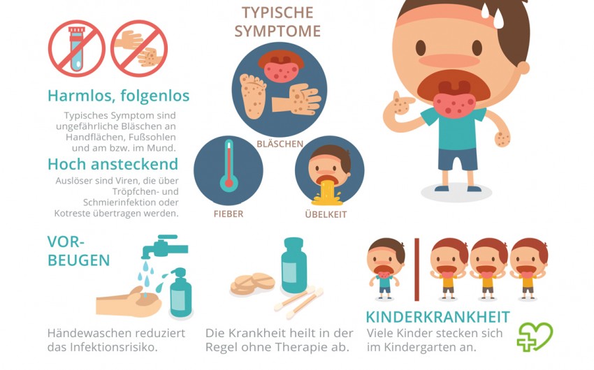 Die Hand-Fuß-Mund-Krankheit heilt meist ohne Therapie ab. Durch Hygiene-Maßnahmen lässt sich das Risiko einer Ansteckung reduzieren.