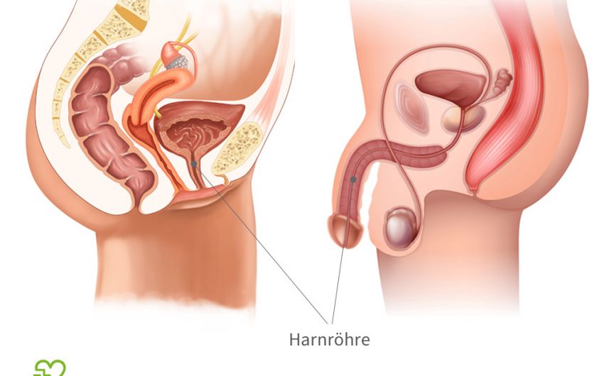 Harnrohrenentzundung Urethritis Ursachen Anzeichen Behandlung Onmeda De