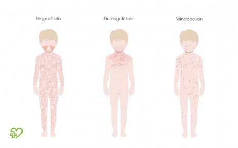 Hautausschlag Ursachen Behandlung Bilder Onmeda De