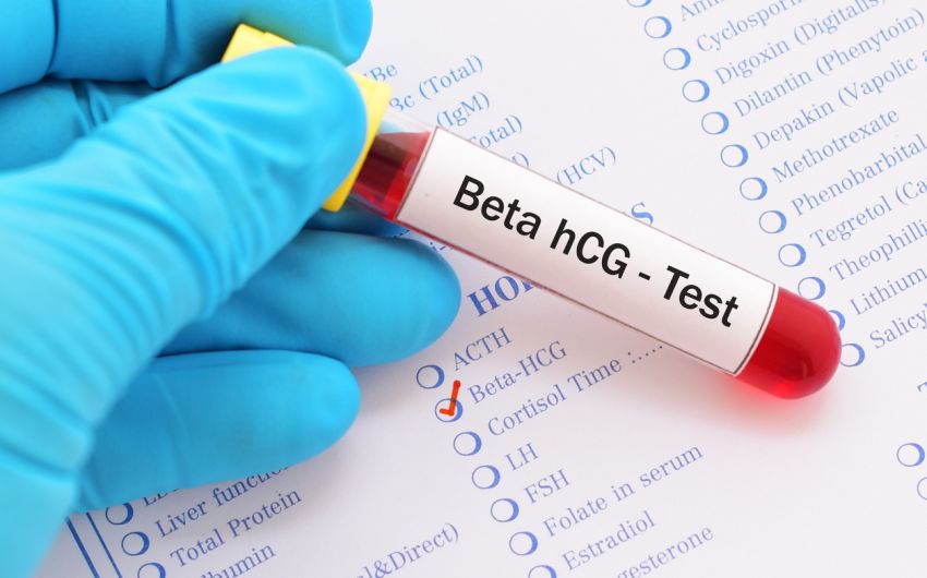 Eileiterschwangerschaft, Bauchhöhlenschwangerschaft: Jemand hält ein Röhrchen mit roter Flüssigkeit und der Aufschrift Beta HCG-Test in der Hand.