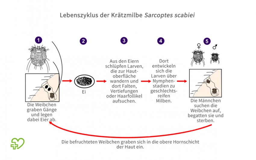 Lebenszyklus der Krätzmilbe.