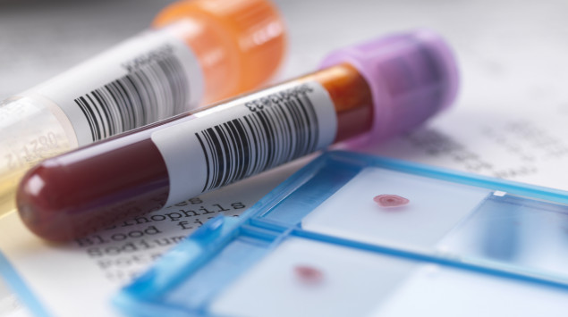 Man sieht zwei Probenröhrchen und zwei Objektträger mit Blutprobe: Eine Thrombozytopenie ist oft ein Zufallsbefund beim kleinen Blutbild.