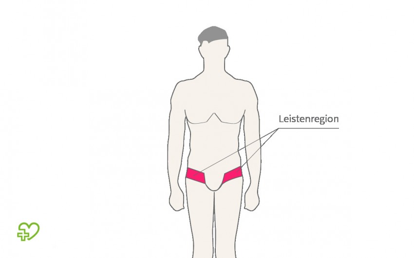 Leistenschmerzen Nicht Immer Steckt Ein Leistenbruch Dahinter Onmeda De