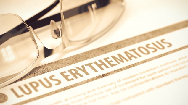 Das Bild zeigt die Aufschrift "Lupus erythematosus" auf einem Papier.