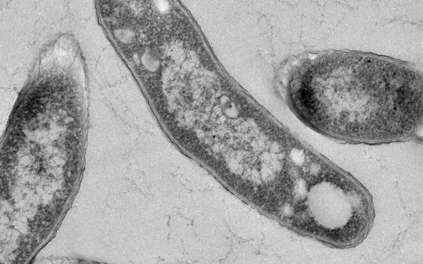 Man sieht den Erreger Mycobacterium tuberculosis unter dem Transmissions-Elektronenmikroskop.