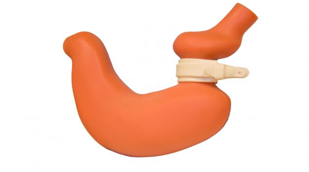 Grafische Darstellung eines Magenbands