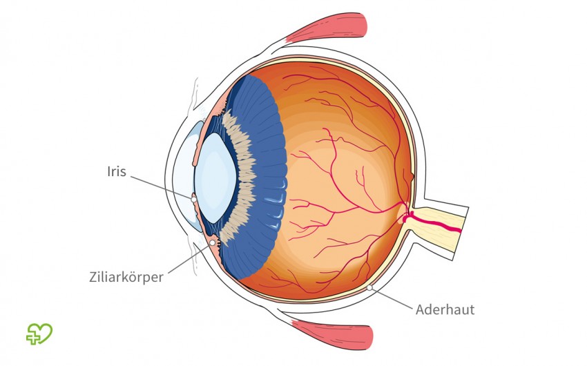 Der Aufbau des Auges im Querschnitt. Gekennzeichnet ist die Aderhaut, der Ziliarkörper und die Iris.