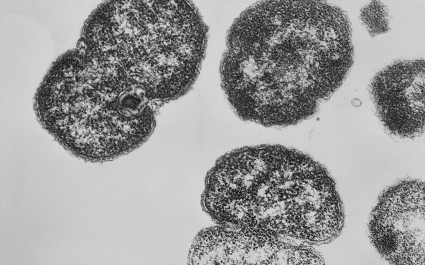 Man sieht eine Aufnahme von Neisseria gonorrhoea mit dem Transelektronenmikroskop.