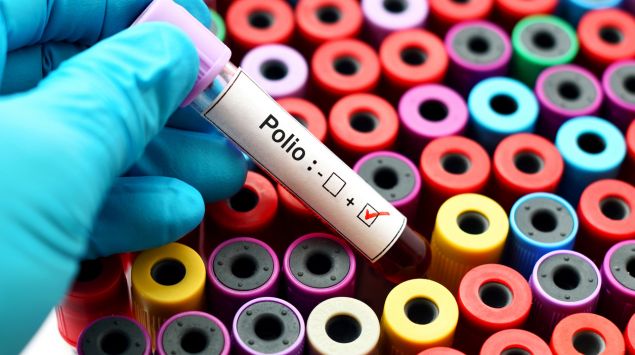 Ein Teströhrchen mit der Aufschrift "Polio"