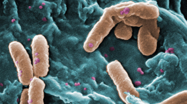 Man sieht eine Aufnahme der Baktierienart Pseudomonas aeruginosa mit dem Rasterelektronenmikroskop (REM).