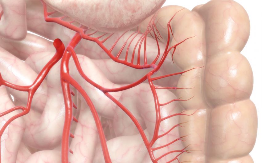 Das Bild zeigt eine illustrierte Arterie.