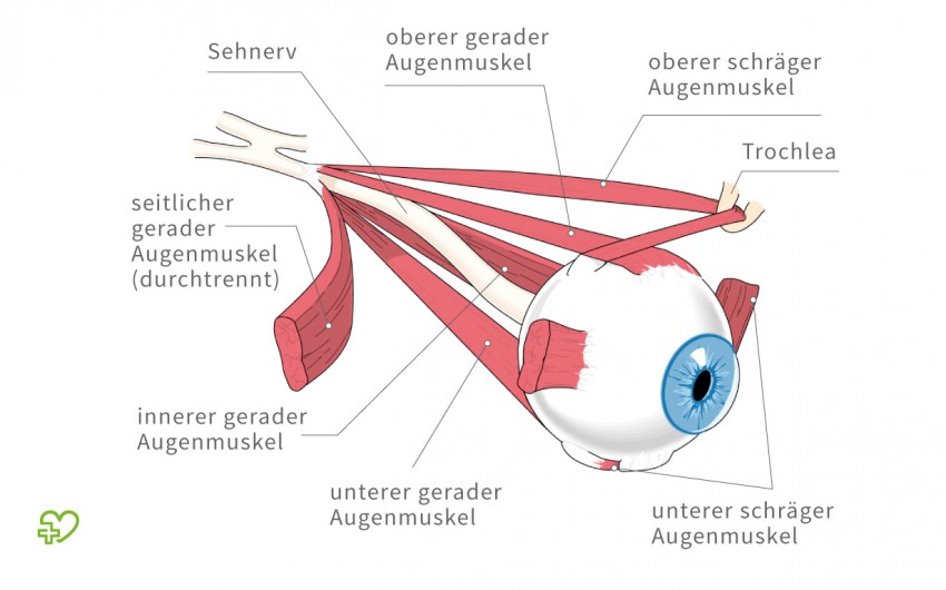 Eine grafische Darstellung der äußeren Augenmuskeln. Jede Bewegung ist ein komplexes Zusammenspiel der Augenmuskeln zueinander.