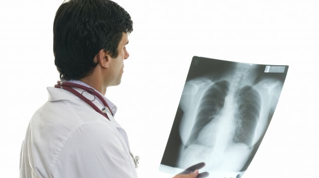 Ein Arzt betrachtet ein Röntgenbild, auf dem der Brustkorb eines Patienten zu erkennen ist.