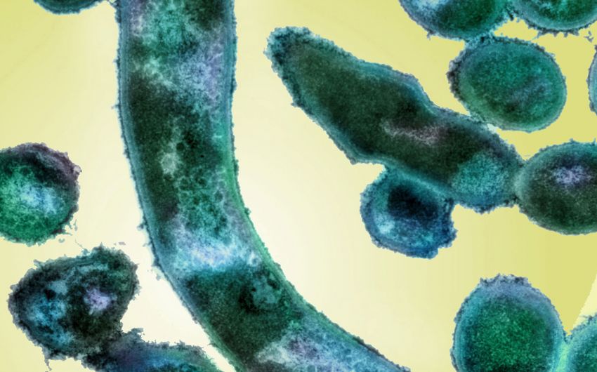 Das Bild zeigt das Bakterium Corynebacterium diphtheriae unter einem Elektronenmikroskop.
