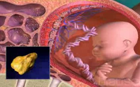Diabetes in der Schwangerschaft Video