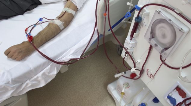 Das Bild zeigt einen Arm, der an einer Dialyse angeschlossen ist.