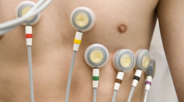 Man sieht sechs auf der Brustwand eines Mannes aufgebrachte EKG-Elektroden.