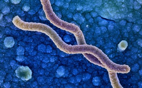 Das Bild zeigt das Bakterium Helicobacter pylori unter einem Elektronenmikroskop.