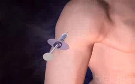 Immunisierung Impfung Video