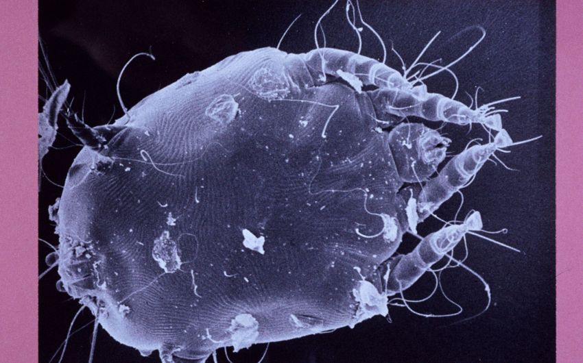 Das Bild zeigt eine Krätzmilbe unter einem Elektronenmikroskop.