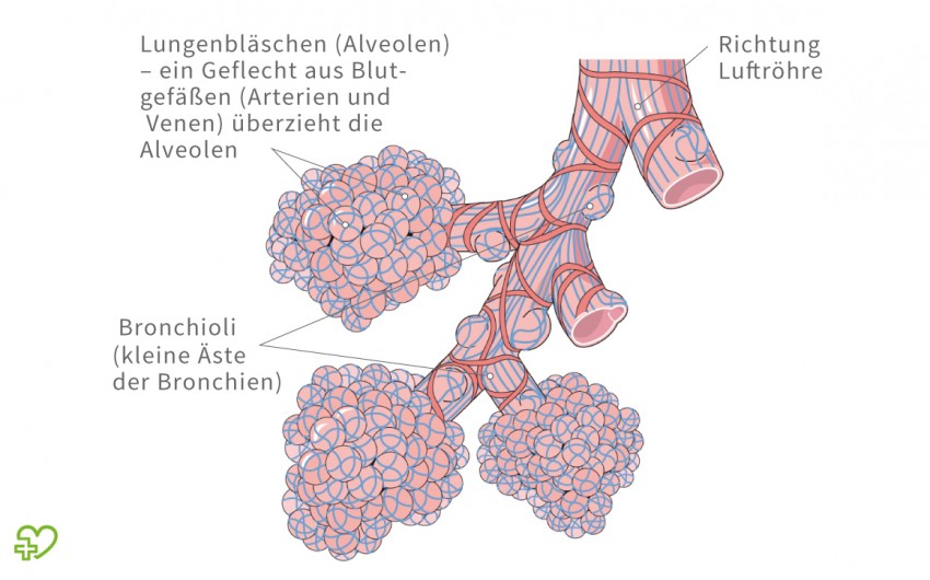 Lungenentzündung: Anatomie der Lungenbläschen