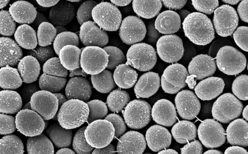 Man sieht eine elektronenmikroskopische Aufnahme von MRSA-Bakterien.
