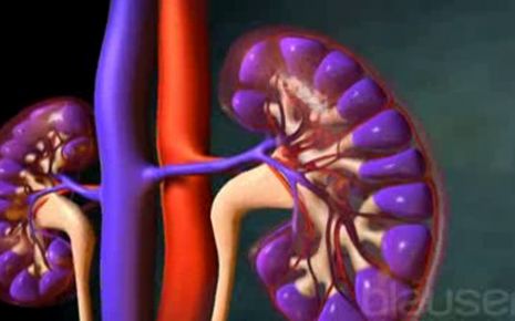 Nierentransplantation Video
