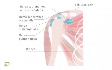 Schleimbeutelentzundung Ursachen Symptome Behandlung Onmeda De