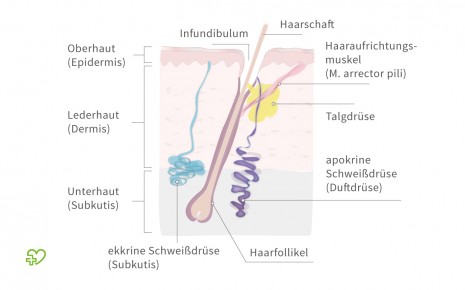 Man sieht einen schematischen Querschnitt durch die Haut mit der Darstellung der Schweißdrüsen.