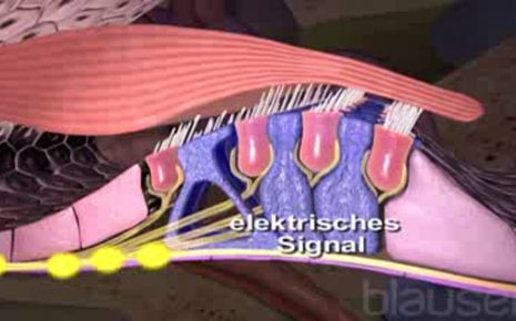 Schwerhoerigkeit Video