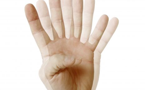 Sehstörungen: Man sieht vier Finger einer Hand.