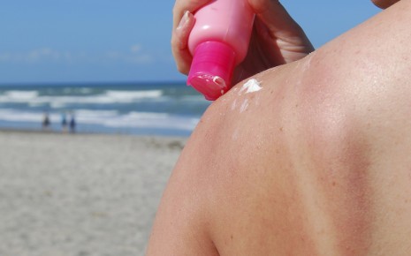Eine Frau mit Sonnenbrand auf dem Rücken trägt Creme auf.