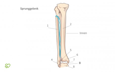 Wadenbeinfraktur