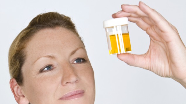 Das Bild zeigt eine Krankenschwester, die eine Urinprobe in der Hand hält.