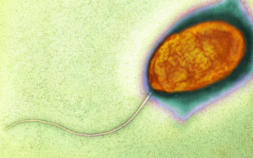 Das Bild zeigt das Bakterium Vibrio cholerae unter einem Elektronenmikroskop