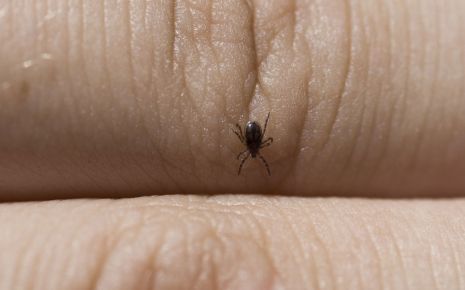 FSME-Risikogebiete: Man sieht eine Zecke auf einer Hand.
