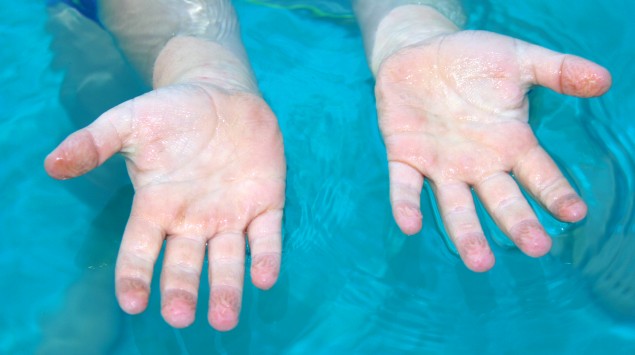 Hände, deren Finger im Wasser schrumpelig geworden sind